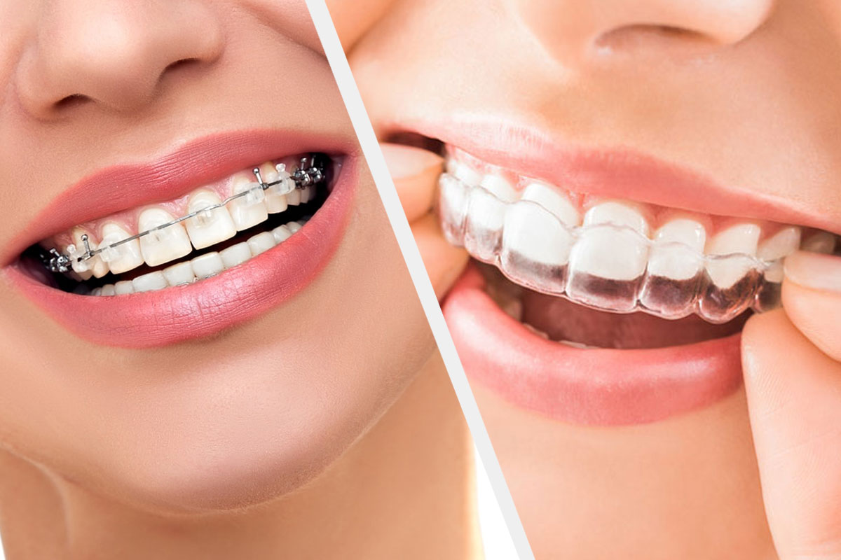 R&B Dental Clinic - Laser and Implant Centre