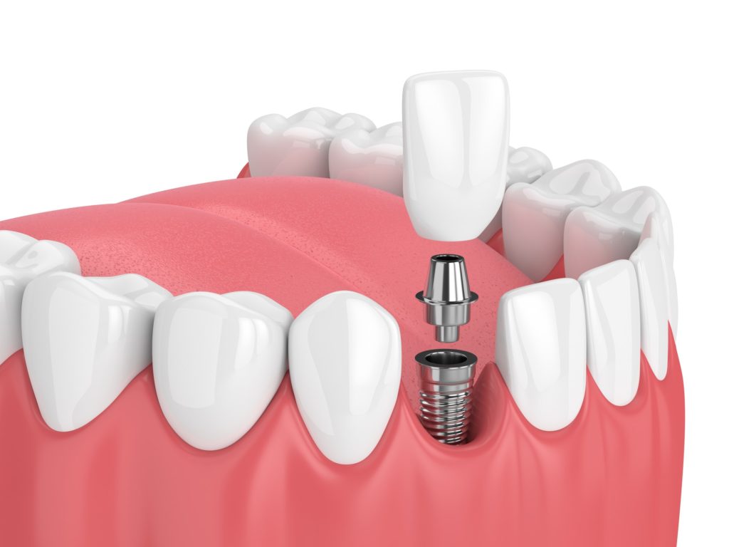 R&B Dental Clinic - Laser and Implant Centre