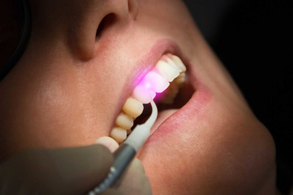 R&B Dental Clinic - Laser and Implant Centre