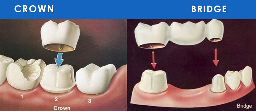 R&B Dental Clinic - Laser and Implant Centre